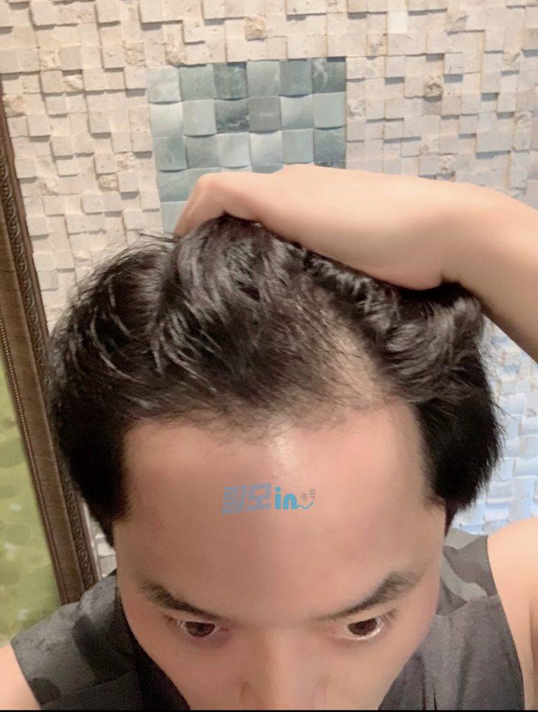 핀주브 800정 photo review