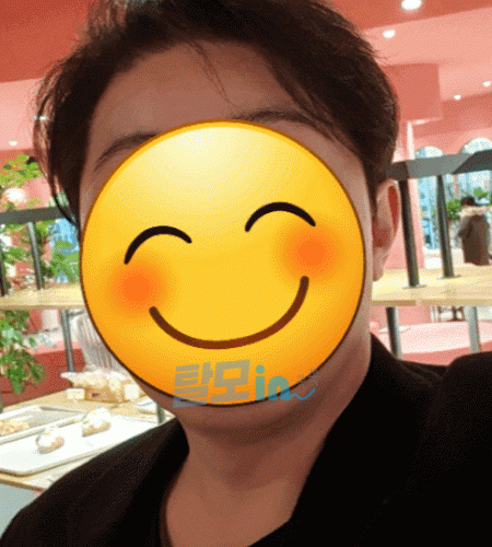 미녹시헤드F 600정 photo review